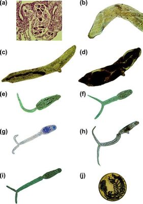  Pseudamphistomum，A Tiny Trematode That Will Make You Question Your Seafood Choices! 